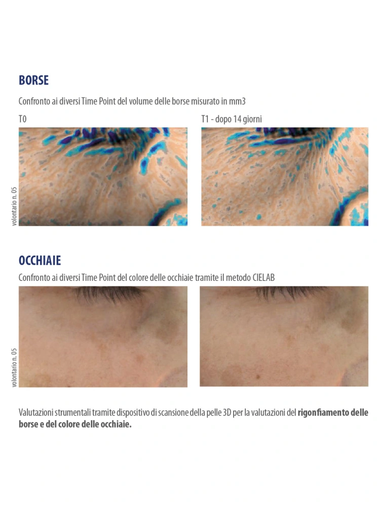 Gel serum anticearcan si antipungi